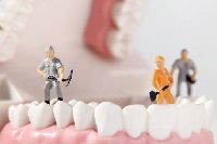 【健康解碼】洗牙會損害牙齒嗎？